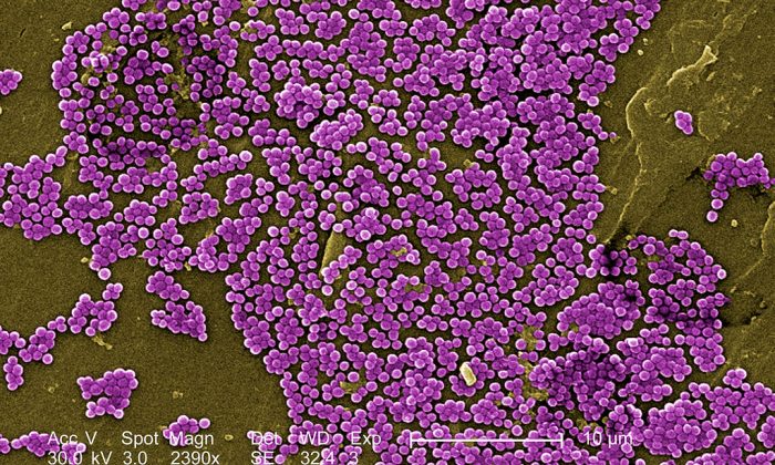 1024px Methicillin Resistant Staphylococcus Aureus 10047